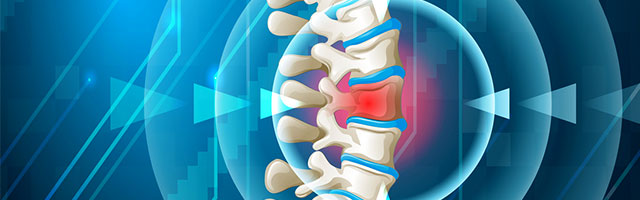 back pain graphic